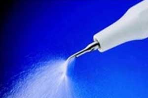 Limpieza dental raticular limpieza dental raspado raticular