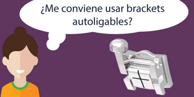 brackets autoligables ventajas me conviene