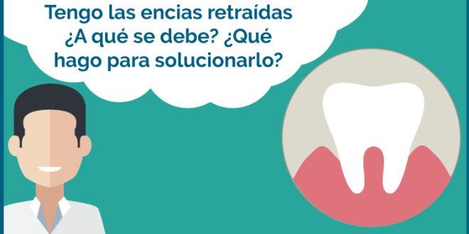 encías retraídas burgos solucion