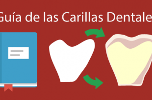 guia completa carillas dentales