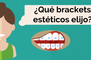 brackets estéticos burgos elegir