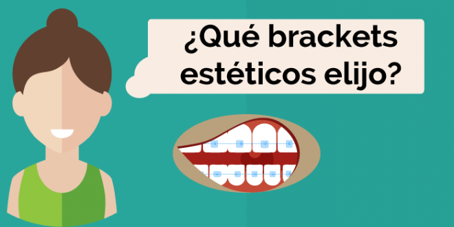 brackets estéticos burgos elegir