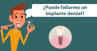 complicaciones de los implantes dentales