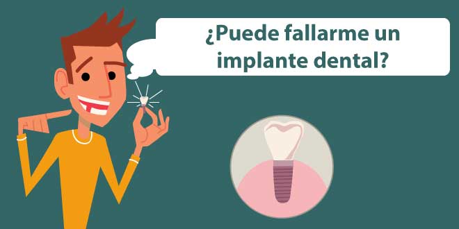 complicaciones de los implantes dentales