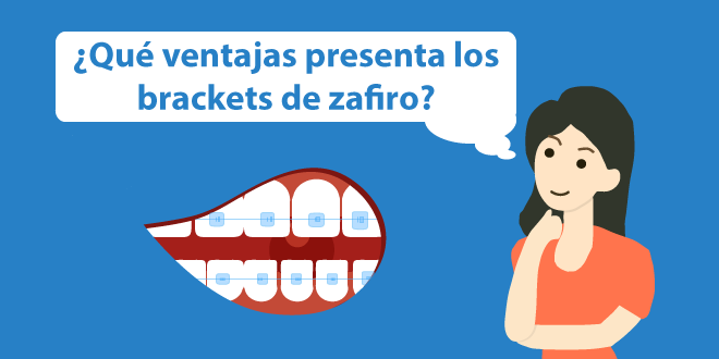 ventajas brackets de zafiro burgos