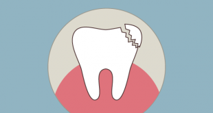 dientes rotos solución burgos